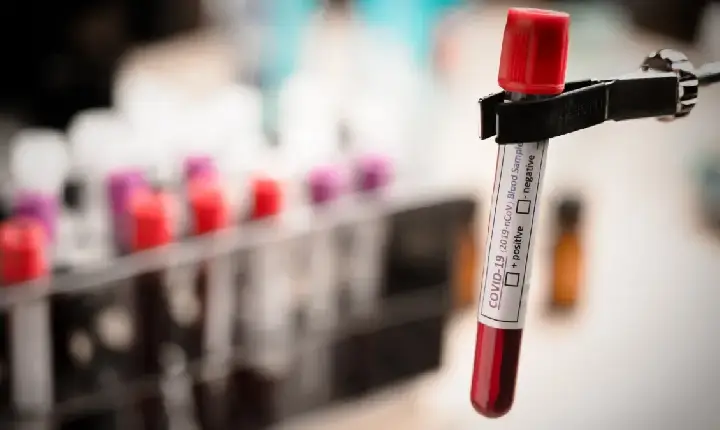 Exame de sangue que detecta mais de 50 tipos de câncer chega ao Brasil