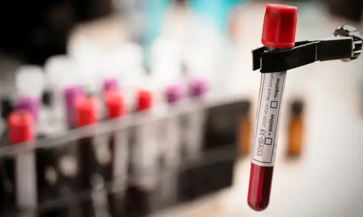 Exame de sangue que detecta mais de 50 tipos de câncer chega ao Brasil